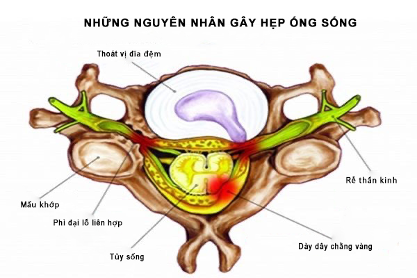 z4690305449899 81aae006fad8b7d204c51d1ced0b6852